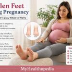 Swollen Feet During Pregnancy