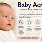 Baby Acne