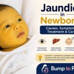 Jaundice in Newborns