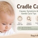 Cradle Cap